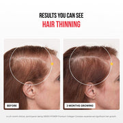 Premium Kolagen Kompleks