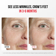 Premium Kolagen Kompleks