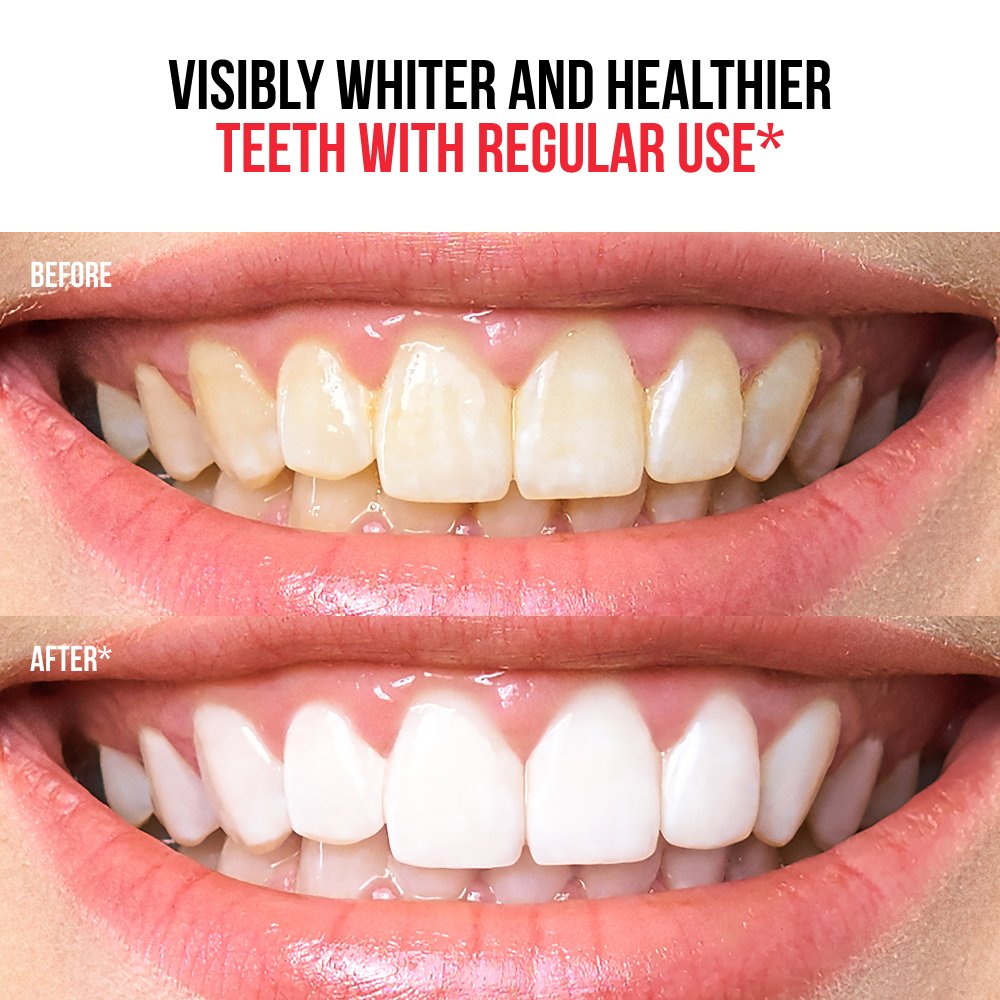 Regenerativna zobna pasta 6 v 1